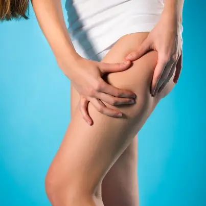 Foods That Fight Cellulite Naturally